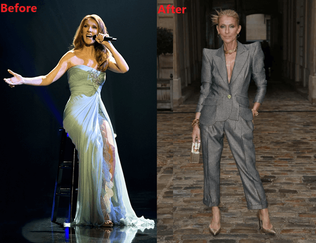 celine dion weight loss before and after