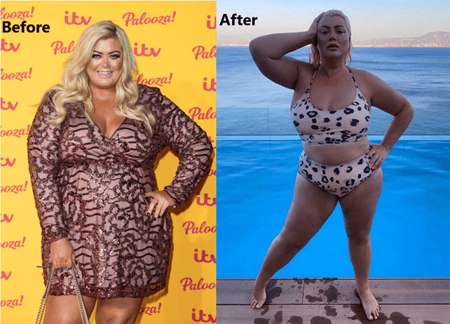 Gemma Collins weight loss before and after